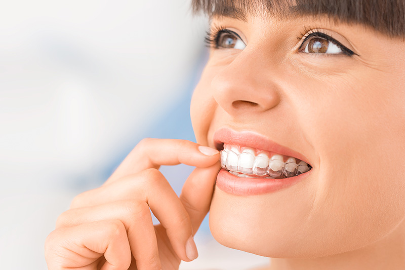 Invisalign in Vallejo
